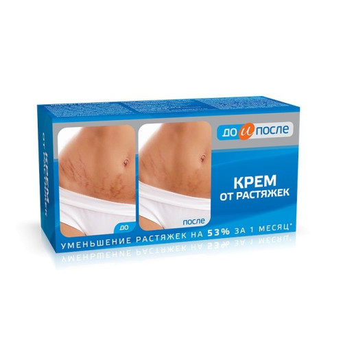Before and After Body Cream for Removing Unwanted Stretch Marks 3.38 fl oz (100 ml)