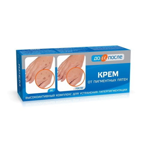 Before and After Cream Against Pigment Spots and Their Reappearance for Hands and Body 1.69 fl oz (50 ml)