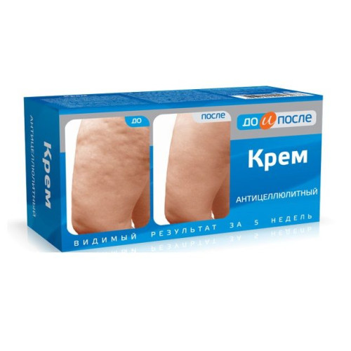 Before and After Anti-Cellulite Cream for Burning Fat from the Body 3.38 fl oz (100 ml)