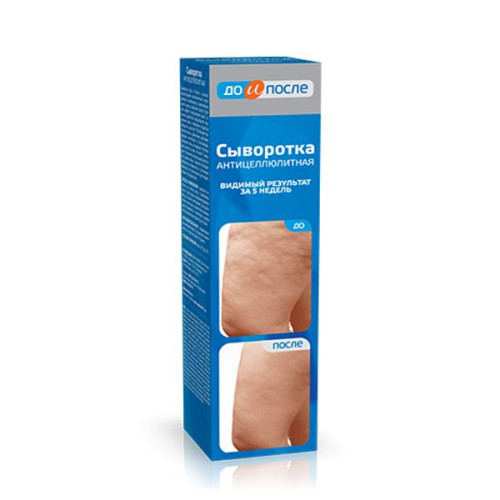 Before and After Anti-Cellulite Serum for Burning Body Fat 4.4 fl oz (130 ml)
