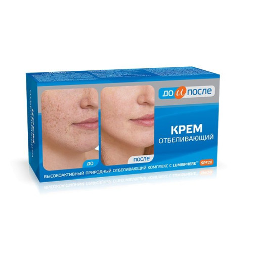 Before and After Whitening Cream for a Beautiful and Smooth Face with SPF 20 3.38 fl oz (100 ml)