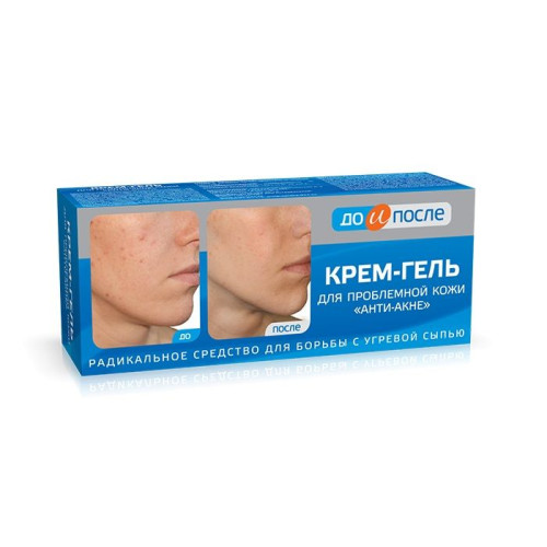 Before and After Anti-Acne Cream-Gel for Removing Acne on Problem Skin 1.69 fl oz (50 ml)